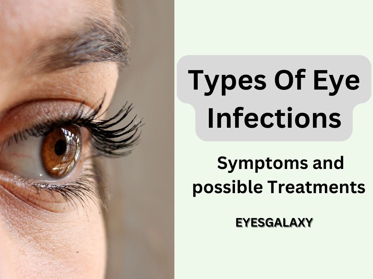 Types Of Eye Infections Their Symptoms And Possible Treatments Eyes Galaxy 4868